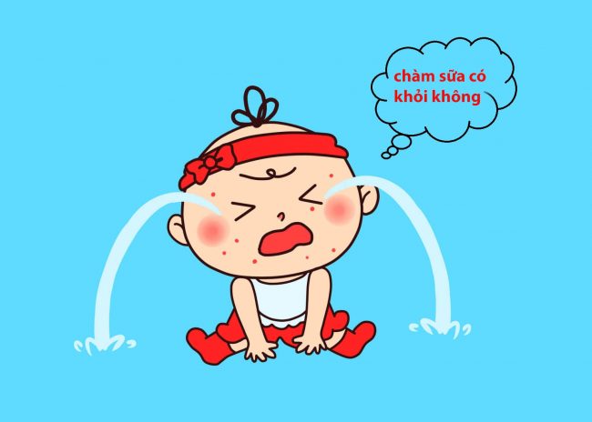 bệnh chàm sữa kiêng gì nhanh khỏi