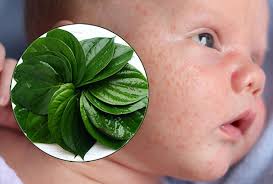 Tắm cho trẻ bị chàm sữa bằng lá trầu không