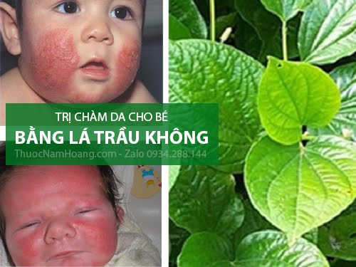cách trị chàm sữa bằng lá trầu không