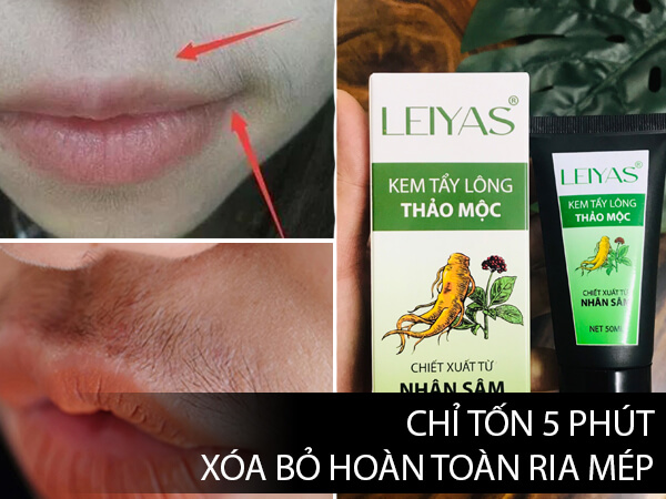 Nên chọn kem tẩy ria mép LEIYAS hay oxy già