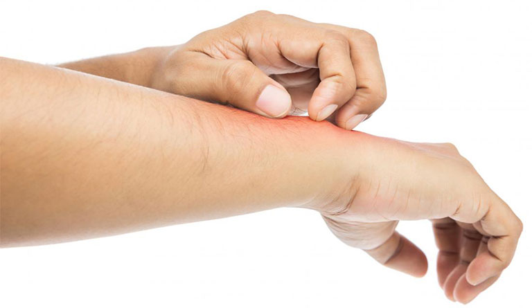 Tại sao ngứa khắp người càng gãi càng ngứa?