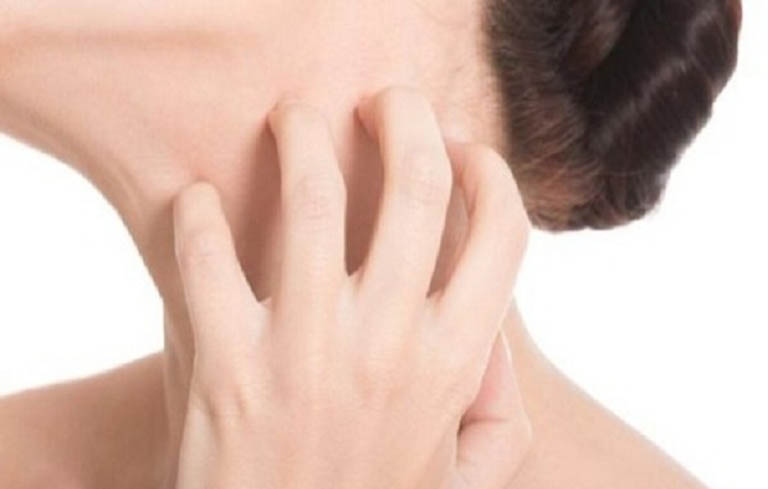 ngứa toàn thân như kiến bò