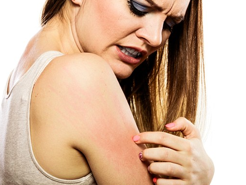dấu hiệu ngứa toàn thân như kiến bò