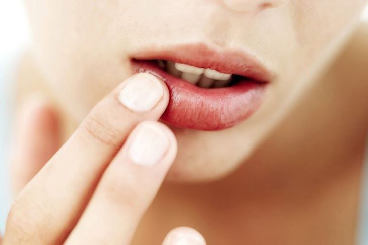 Thiếu chất dinh dưỡng gây ngứa miệng