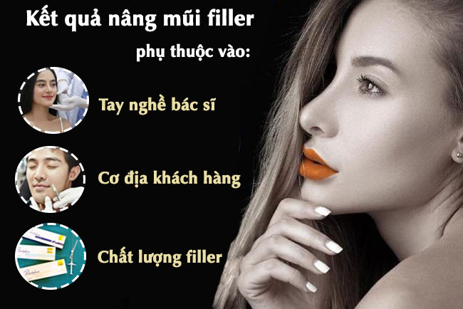 nâng mũi tiêm filler có sưng mấy ngày