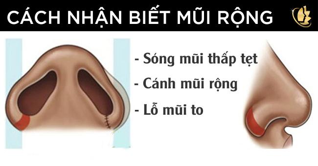 làm sao cánh mũi nhỏ lại