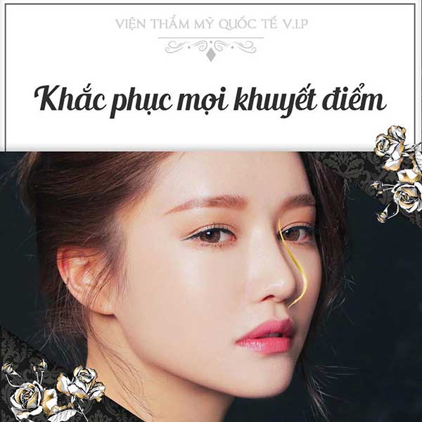 Nâng mũi bằng sụn tai có nên không