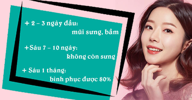 nâng mũi có được đeo kính không