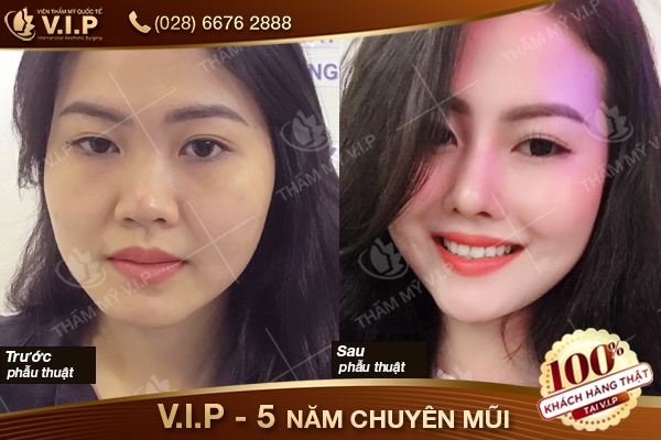 đẹp ở vip