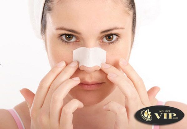 Nâng mũi bằng sụn tự thân có ảnh hưởng sức khỏe không
