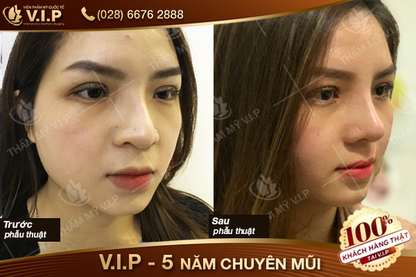 thẩm mỹ làm đẹp