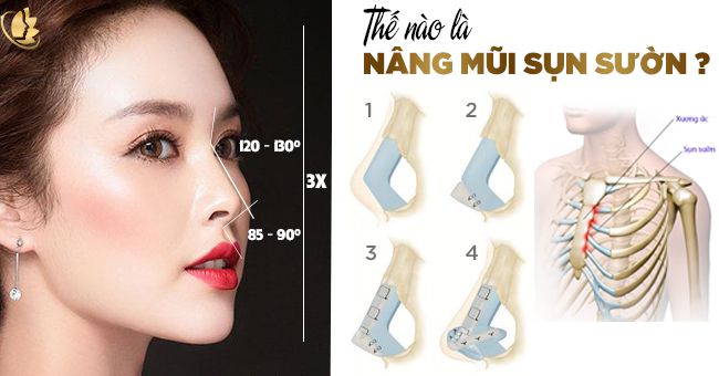 Thế nào là nâng mũi sườn