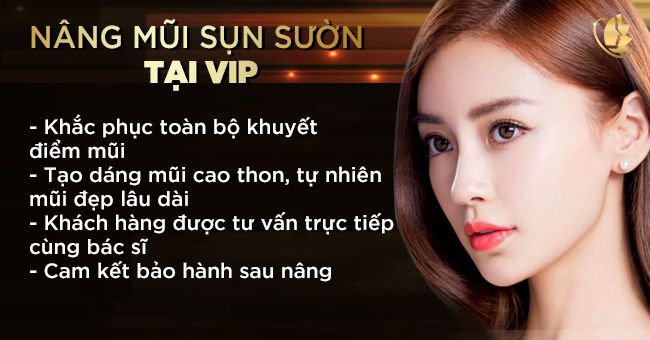 nâng mũi sụn sườn