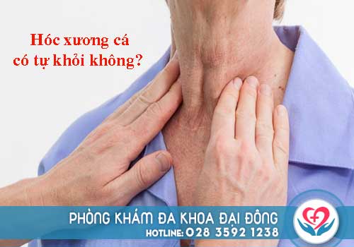 Hóc xương cá có tự khỏi không