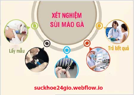 xét nghiệm sùi mào gà bằng cách nào