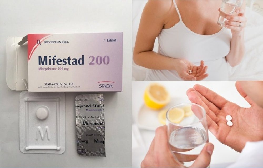 Chi phí thuốc phá thai mifepristone và misoprostol giá bao nhiêu