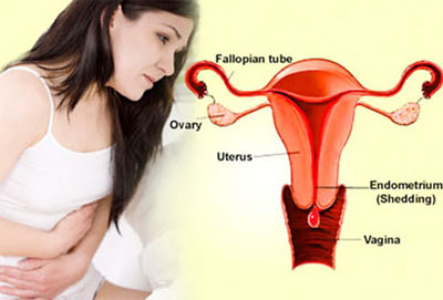 phân loại kinh nguyệt không đều