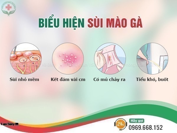 biểu hiện sùi mào gà