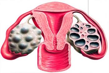 chậm kinh đau bụng lâm râm có nguy hiểm không
