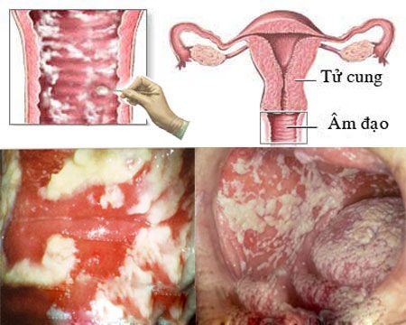 Ngứa môi lớn vùng kín sau khi quan hệ có sao không