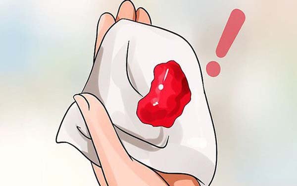 Cách chữa kinh nguyệt vón cục tại nhà hiệu quả