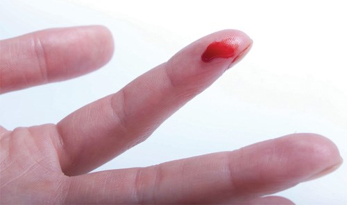 Ra máu hồng giữa kỳ kinh có sao không và Cách chữa trị