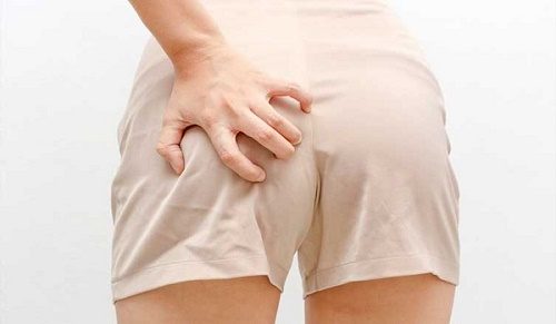 Ngứa hậu môn có nguy hiểm không và cách chữa trị tại nhà