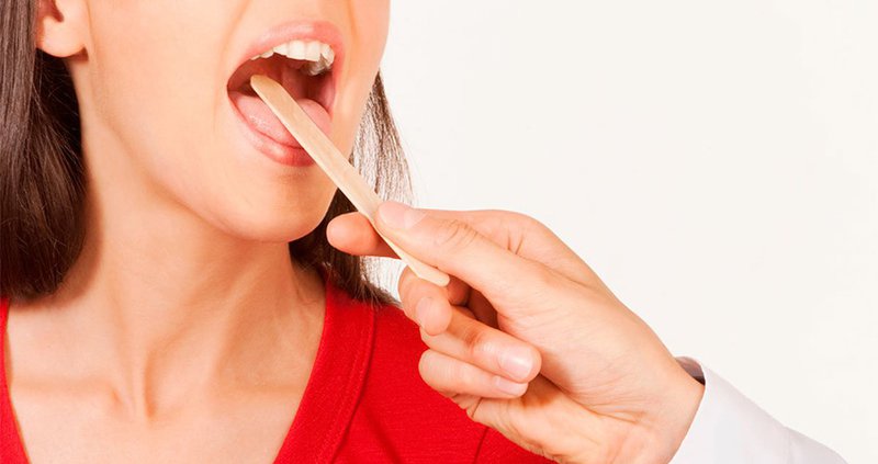 U nhú tiền đình ở lưỡi miệng Triệu Chứng và Cách chữa trị