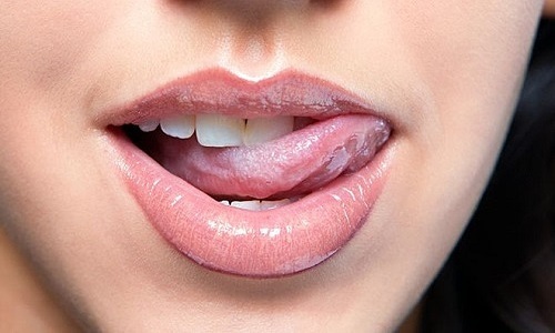 U nhú tiền đình ở lưỡi miệng Triệu Chứng và Cách chữa trị