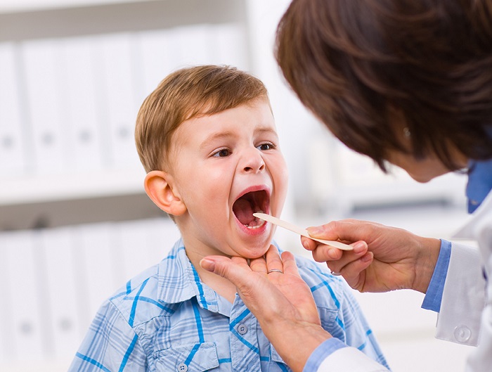 Hình ảnh viêm họng hạt ở trẻ em và người lớn chi tiết