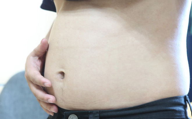 Phá thai xong bụng vẫn to có Nguy Hiểm không