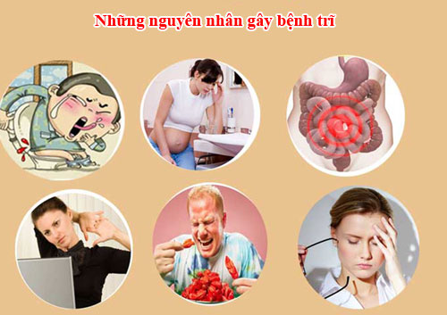 Những nguyên nhân gây bệnh trĩ