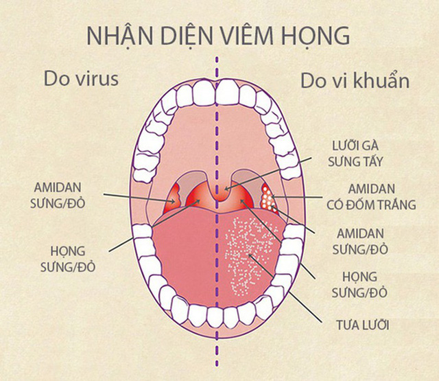Đau họng lâu ngày có sao không
