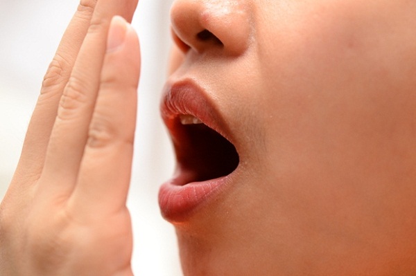 Đau họng có mủ là bệnh gì