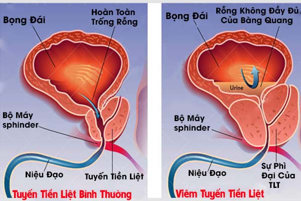 Tinh trùng có màu vàng đục