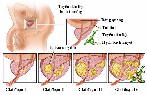Tinh trùng có màu vàng đục