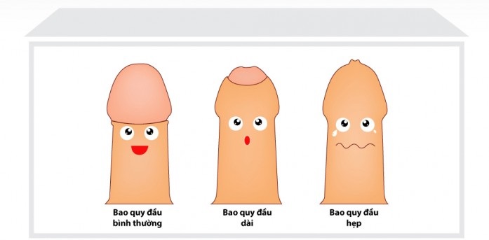 Dương vật có mùi hôi là bệnh gì