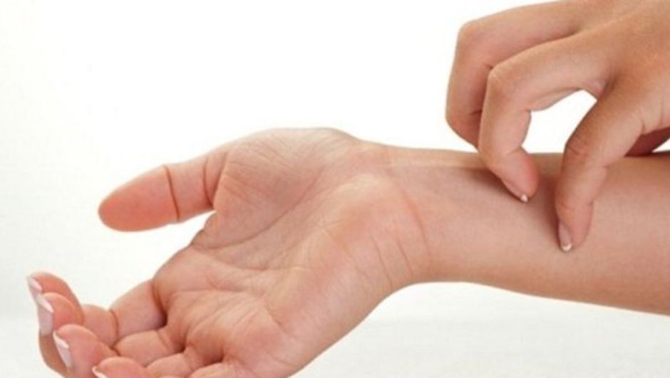 Hình ảnh bệnh da liễu