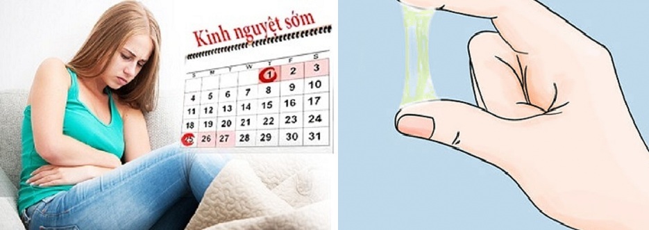 Huyết trắng có màu vàng không hôi trước kì kinh
