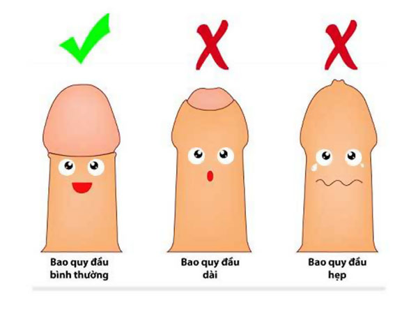 Hẹp bao quy đầu là gì?