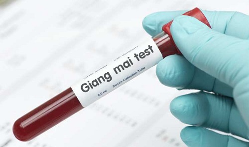 Lựa chọn địa chỉ xét nghiệm giang mai tốt và chính xác nhất