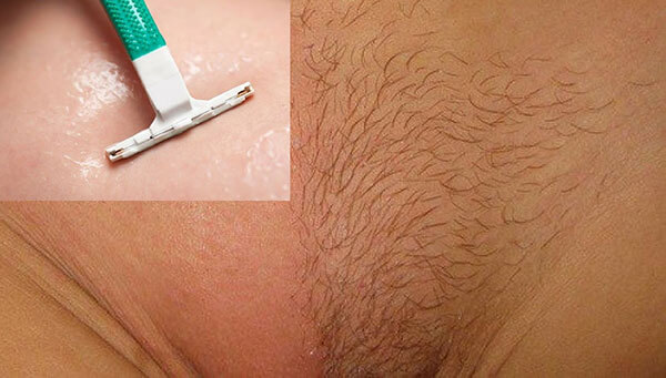 Tác dụng của lông mu đối với sức khỏe của nam và nữ giới