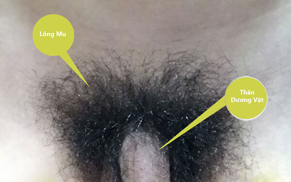 Một số hình ảnh lông mu ở nam giới