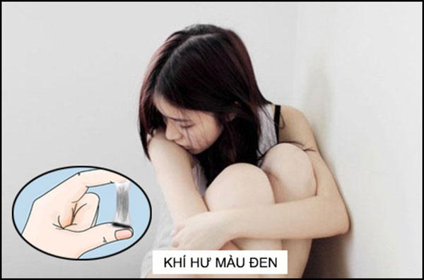 Trường hợp khí hư có màu đen do mắc phải các bệnh lý phụ khoa