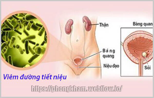 10 cách điều trị viêm đường tiết niệu hiệu quả hiện nay