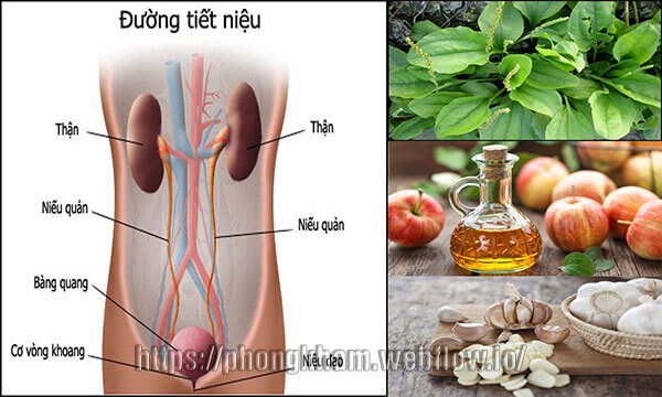 9 cách Điều trị viêm đường tiết niệu bằng các phương pháp dân gian