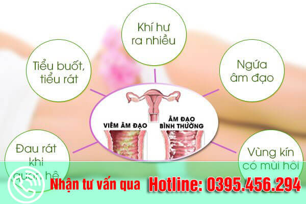 Bệnh viêm âm đạo do nấm dấu hiệu biểu hiện