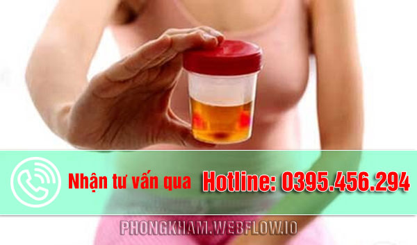 Hiện tượng đi tiểu ra máu là dấu hiệu của bệnh gì?