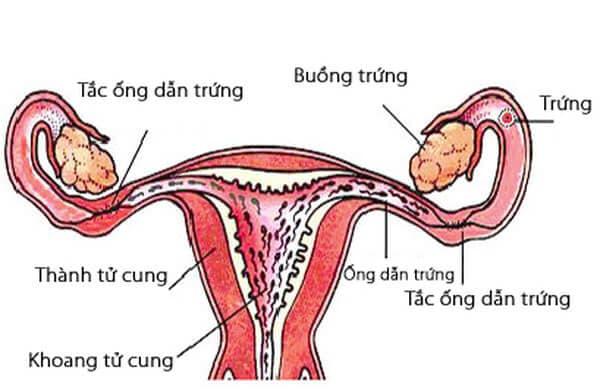 Các phương pháp chữa tắc vòi trứng, ống dẫn trứng hiệu quả hiện nay