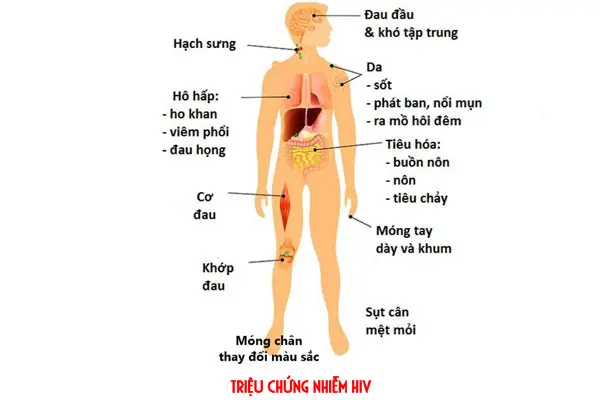 Quan hệ với người nhiễm HIV bao lâu thì bị phát bệnh?